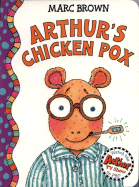 Arthur's Chicken Pox: An Arthur Adventure