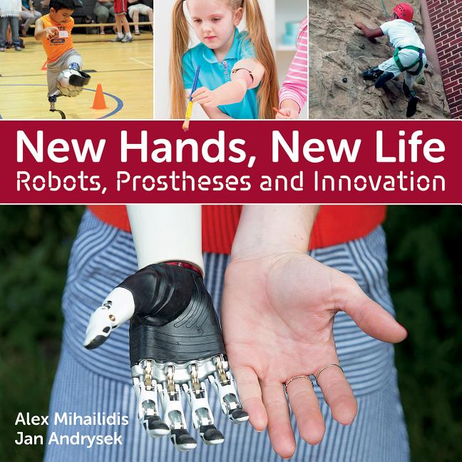New Hands, New Life: Robots, Prostheses and Innovation