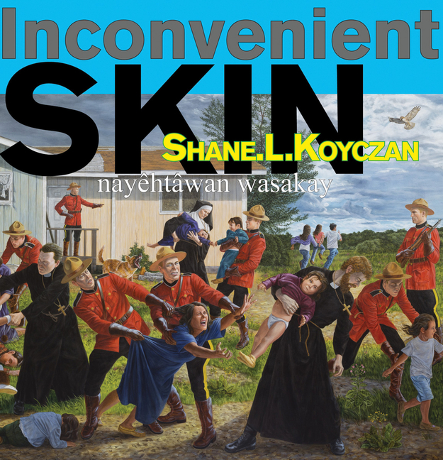 Inconvenient Skin / Nayêhtâwan Wasakay